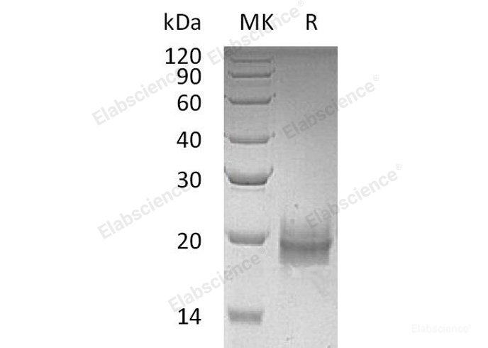 Recombinant Human Trefoil Factor 2/TFF2 Protein(C-6His)-Elabscience