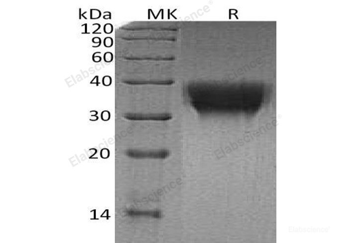 Recombinant Human TREM-1/CD354 Protein(C-6His)-Elabscience