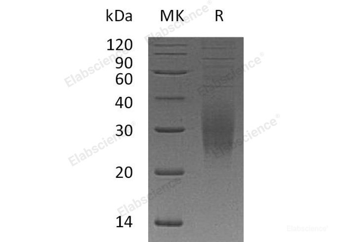 Recombinant Human Triggering Receptor Expressed On Myeloid 2/TREM-2 Protein(C-6His)-Elabscience