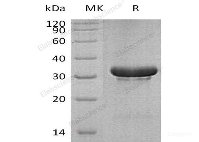 Recombinant Human Tripartite Motif-Containing Protein 5/TRIM5/RNF88 Protein(N-6His)-Elabscience