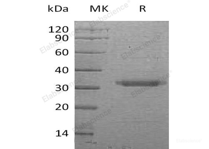 Recombinant Human Tryptase epsilon/Brain-Specific Serine Protease 4/BSSP-4 Protein(C-6His)-Elabscience