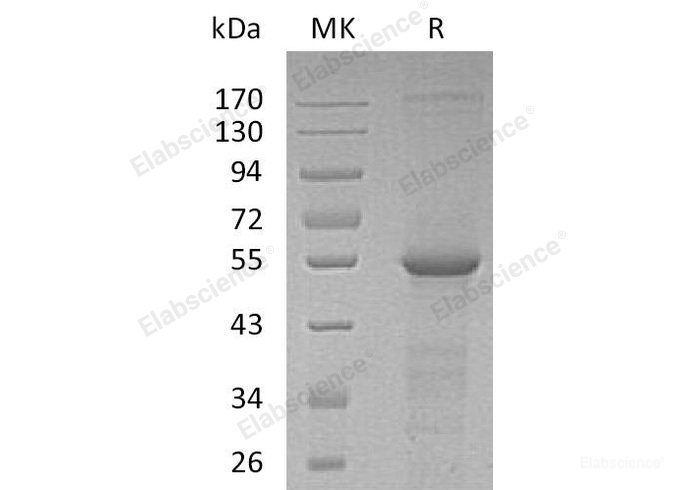 Recombinant Human Tubulin β-4A Chain/TUBB4A Protein(N-6His)-Elabscience