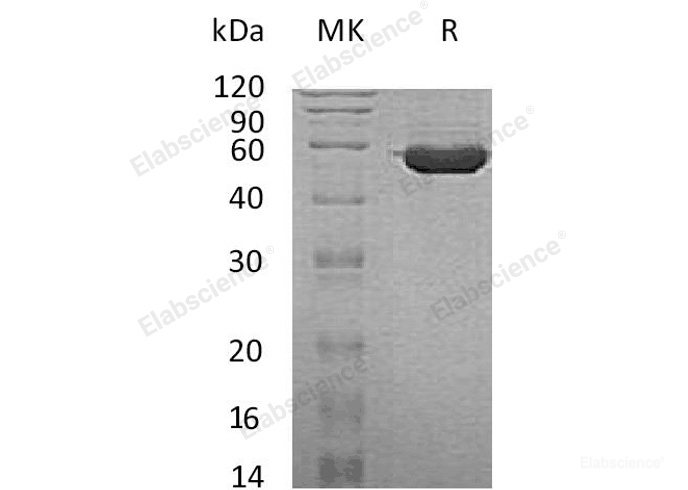Recombinant Human Tubulointerstitial Nephritis Antigen-Like 1/TINAGL1 Protein(C-6His)-Elabscience