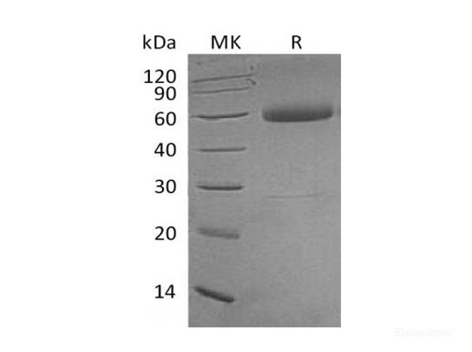 Recombinant Human Tumor Necrosis Factor Receptor I/TNFRSF1A/CD120a Protein(C-Fc)-Elabscience
