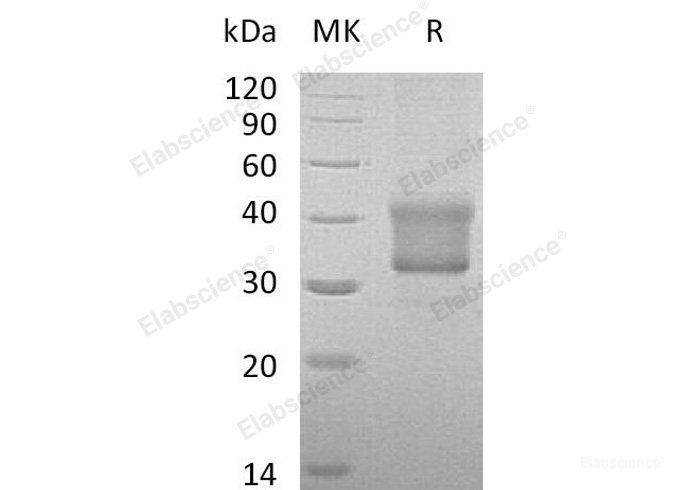 Recombinant Human Tumor Necrosis Factor Receptor II/TNFRSF1B/CD120b Protein(288-461, C-6His)-Elabscience