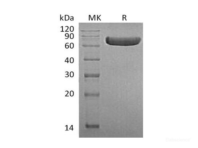 Recombinant Human Tumor Necrosis Factor Receptor II/TNFRSF1B/CD120b Protein(C-Fc)-Elabscience