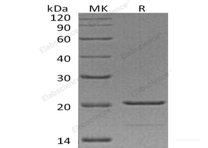 Recombinant Human Tumor Necrosis Factor α/TNFα Protein(N-6His)-Elabscience