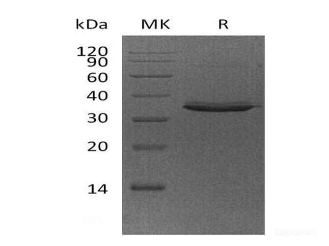 Recombinant Human TWEAK Receptor/TWEAK R/TNFRSF12A Protein(C-Fc)-Elabscience