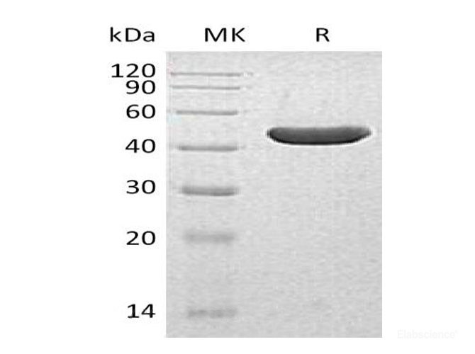 Recombinant Human Type I Inositol 1,4,5-Trisphosphate 5-Phosphatase/INPP5A Protein(C-6His)-Elabscience