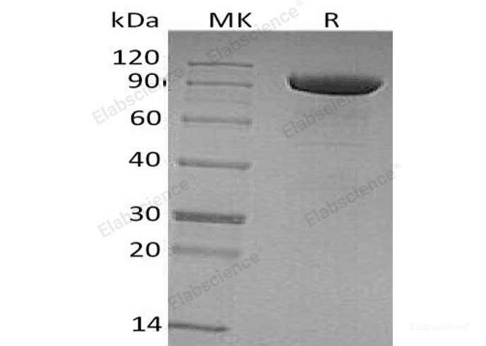 Recombinant Human Tyrosine-Protein Kinase Receptor Tie-1/Tie-1 Protein(C-6His)-Elabscience