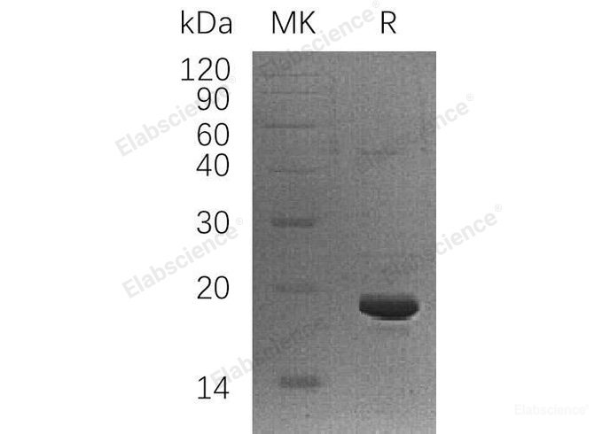 Recombinant Human U6 snRNA-Associated Sm-Like Protein LSm1/LSM1 Protein(C-6His)-Elabscience
