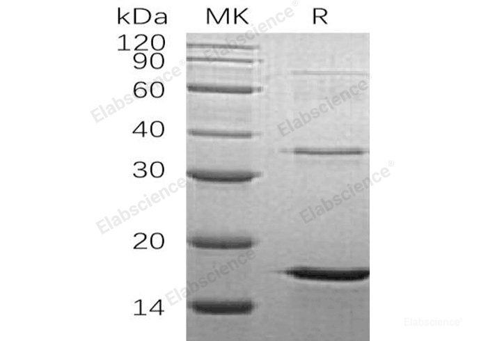 Recombinant Human U6 snRNA-Associated Sm-Like Protein LSm4/LSM4 Protein(N-6His)-Elabscience