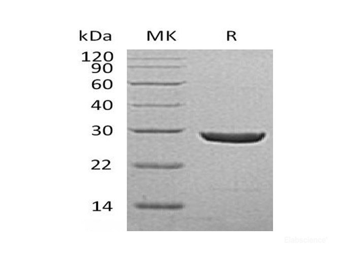 Recombinant Human Ubiquitin Carboxyl-Terminal Hydrolase Isozyme L1/UCH-L1 Protein(C-6His)-Elabscience