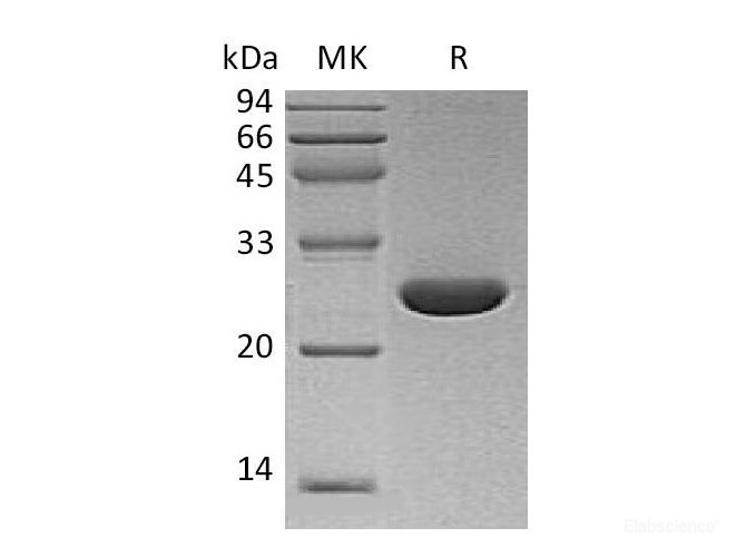 Recombinant Human Ubiquitin Carboxyl-Terminal Hydrolase Isozyme L3/UCH-L3 Protein(C-6His)-Elabscience