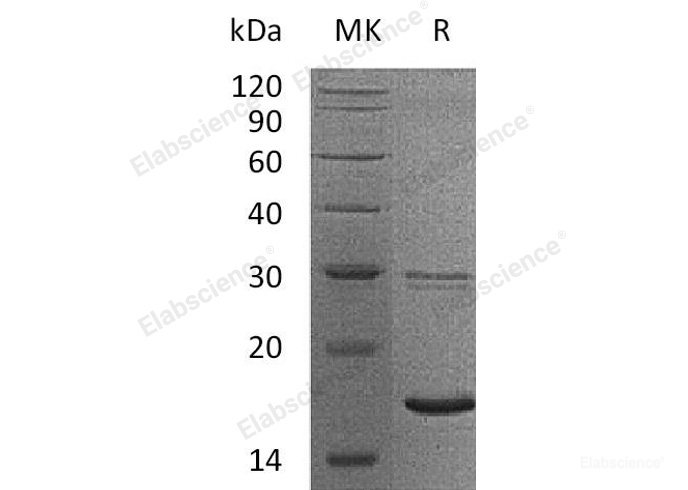 Recombinant Human Ubiquitin-Conjugating Enzyme E2 B/UBE2B/HR6B Protein(C-6His)-Elabscience