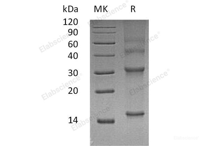 Recombinant Human Ubiquitin-Conjugating Enzyme E2 D3/UBE2D3 Protein-Elabscience