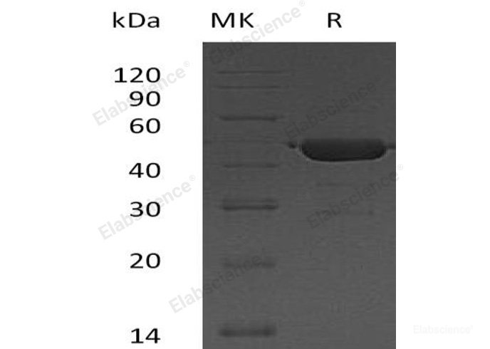 Recombinant Human Ubiquitin-Conjugating Enzyme E2 G2/UBE2G2/UBC7 Protein(N-GST)-Elabscience