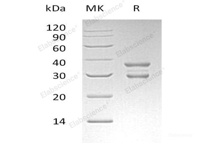 Recombinant Human Ubiquitin-Conjugating Enzyme E2 J2/UBE2J2 Protein(N-GST)-Elabscience