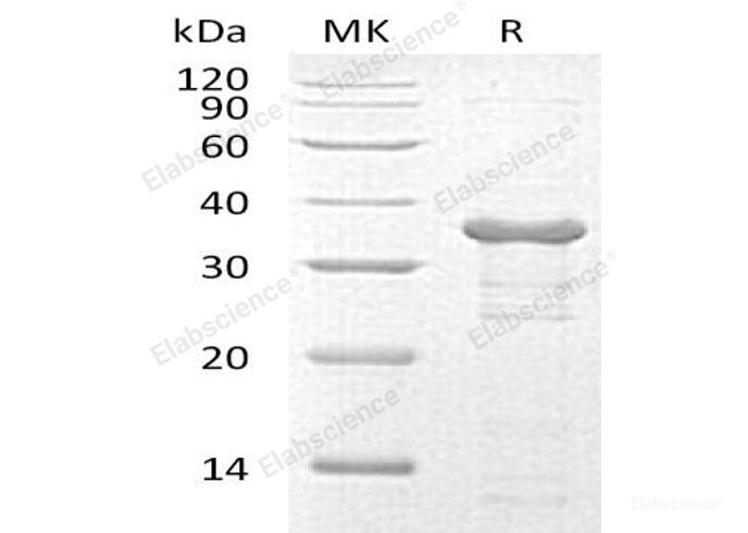 Recombinant Human Ubiquitin-Conjugating Enzyme E2 R2/UBE2R2/UBC3B Protein(N-6His)-Elabscience