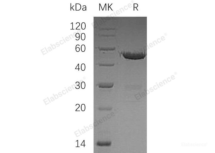 Recombinant Human Ubiquitin-Conjugating Enzyme E2 S/UBE2S Protein(N-GST)-Elabscience
