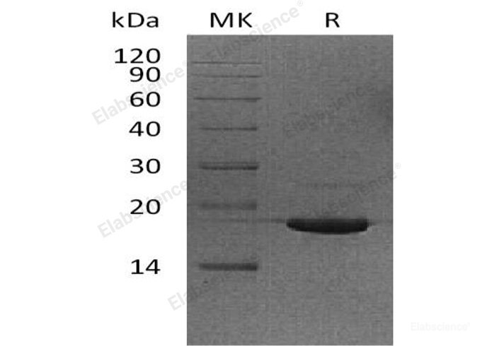 Recombinant Human Ubiquitin-Conjugating Enzyme E2 Variant 2/UBE2V2/DDVIT1 Protein(N-6His)-Elabscience