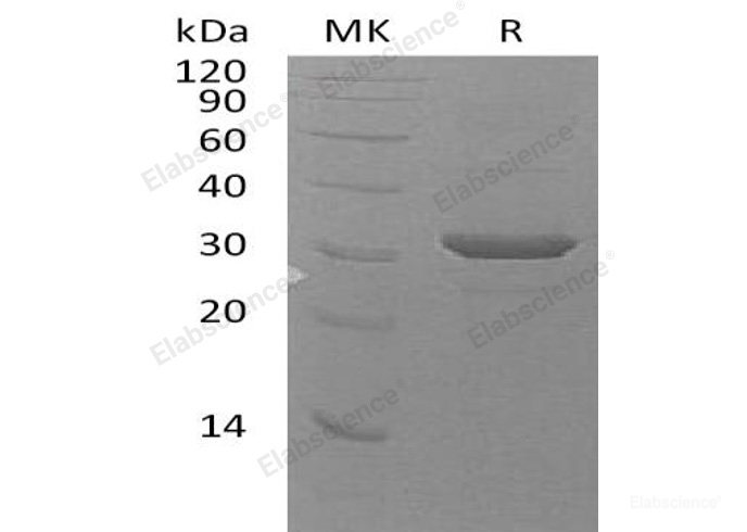 Recombinant Human Ubiquitin-Conjugating Enzyme E2 Z/UBE2Z Protein(N-6His)-Elabscience