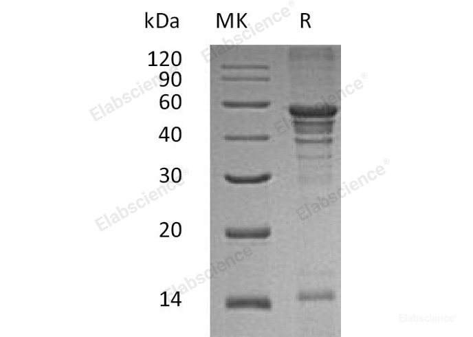 Recombinant Human UFM1-Activating Enzyme 5/UBA5 Protein(N-6His)-Elabscience