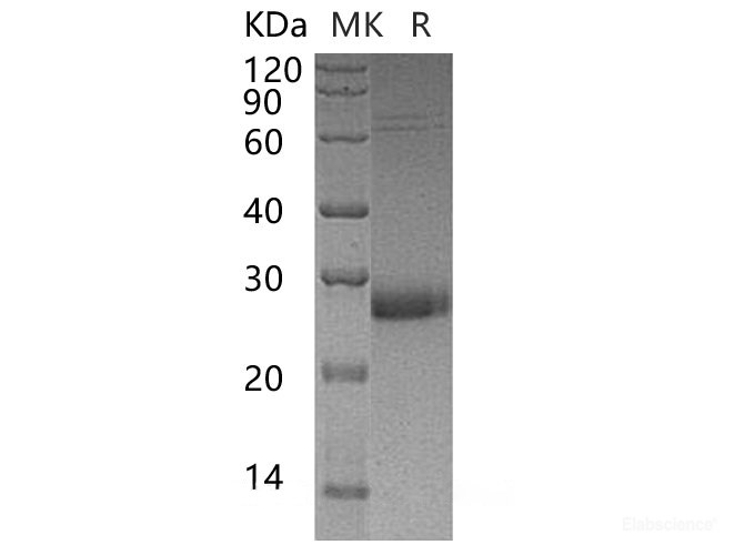 Recombinant Human Uroplakin-2/UPK2 Protein(C-6His)-Elabscience
