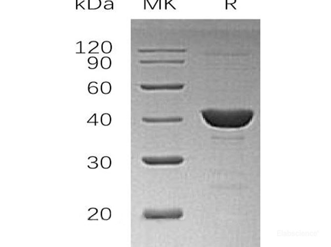 Recombinant Human Uroporphyrinogen Decarboxylase/UROD Protein(N-6His)-Elabscience
