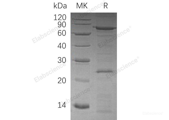 Recombinant Human Valosin-Containing Protein/VCP Protein(C-6His)-Elabscience