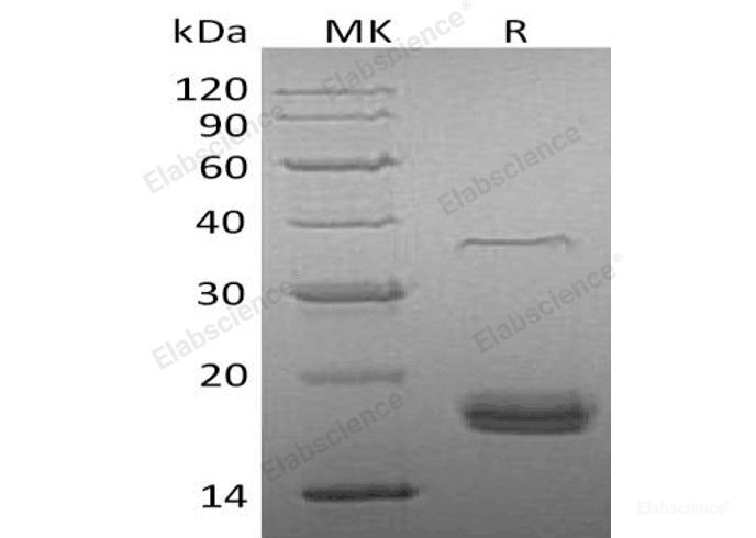 Recombinant Human VEGF-D/FIGF Protein(C-6His)-Elabscience