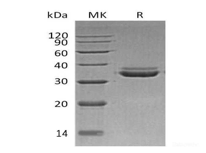 Recombinant Human VIP36-Like Protein/LMAN2L Protein(C-6His)-Elabscience