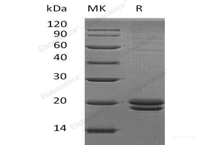Recombinant Human Vitelline Membrane Outer Layer Protein 1 Homolog/VMO1 Protein(C-6His)-Elabscience