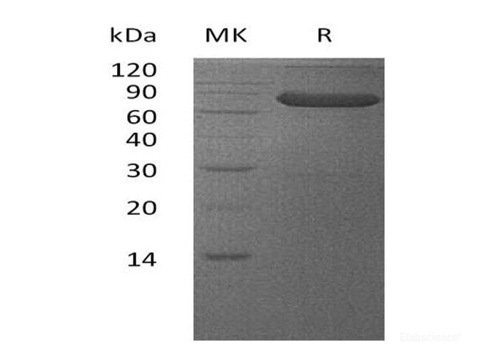 Recombinant Human V-Set and Ig Domain-Containing Protein 4/VSIG4/CRIg Protein(C-Fc)-Elabscience