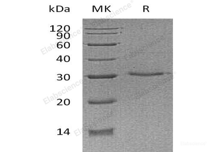Recombinant Human V-Set and Ig Domain-Containing Protein 8/VSIG8 Protein(C-6His)-Elabscience