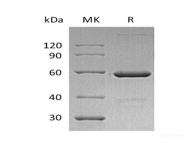 Recombinant Human V-Set and Ig Domain-Containing Protein 8/VSIG8 Protein(C-Fc)-Elabscience