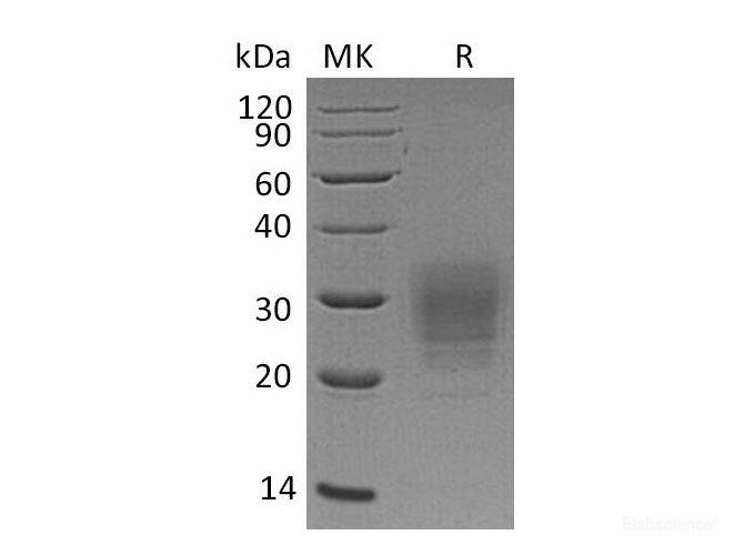 Recombinant Human V-Set and Transmembrane Domain-Containing 1/VSTM1 Protein(C-6His)-Elabscience