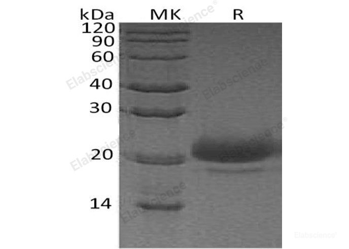 Recombinant Human WAP Four-Disulfide Core Domain Protein 2/WFDC2 Protein(C-6His)-Elabscience