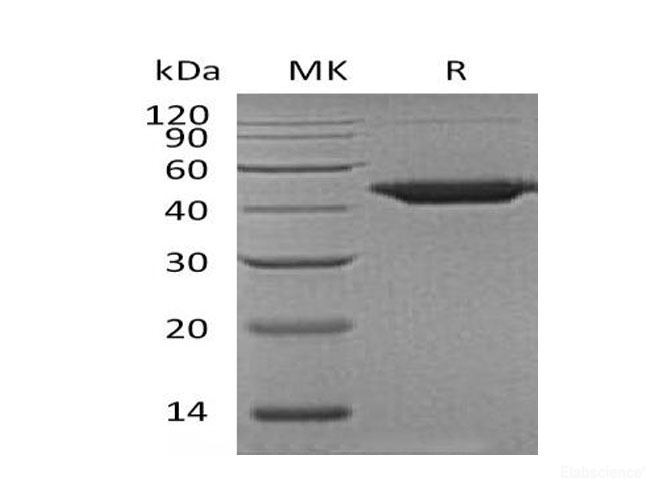 Recombinant Human Wnt Inhibitory Factor 1/WIF-1 Protein(C-6His)-Elabscience