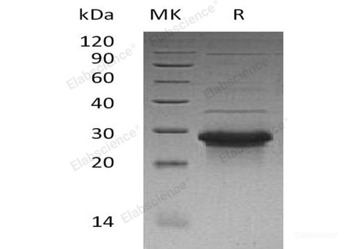 Recombinant Human WW Domain-Binding Protein 1/WBP1 Protein(N-6His)-Elabscience