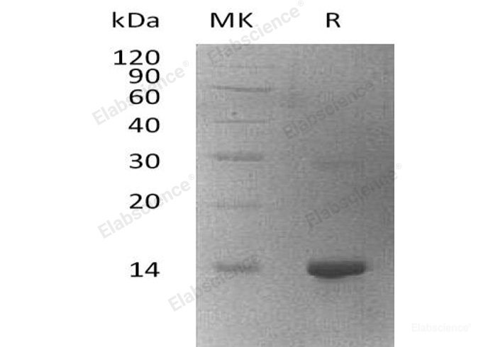 Recombinant Human WW Domain-Binding Protein 2/WBP2 Protein(N-6His)-Elabscience