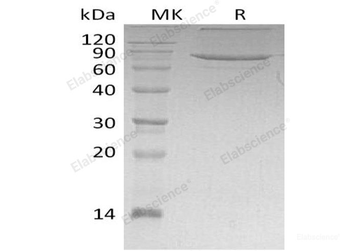 Recombinant Human Xaa-Pro Aminopeptidase 1/XPNPEP1 Protein(C-6His)-Elabscience