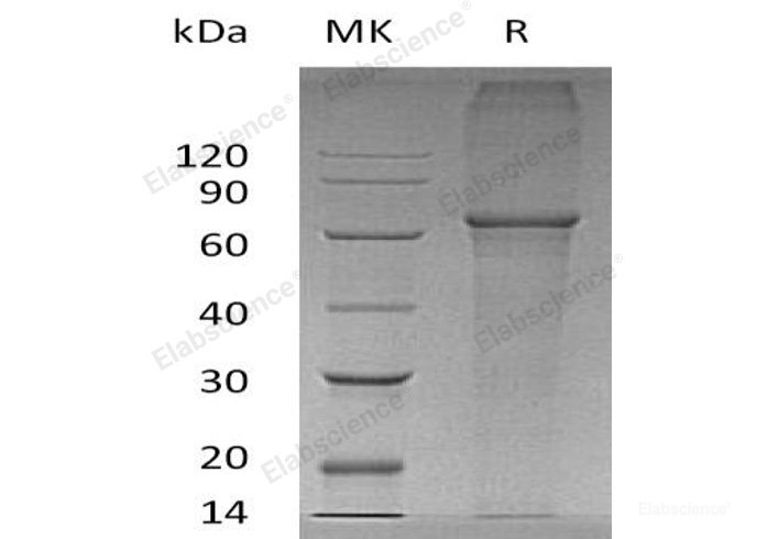 Recombinant Human Xaa-Pro Aminopeptidase P3/XPNPEP3 Protein(N, C-6His)-Elabscience