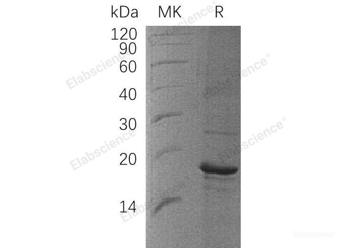 Recombinant Human Z-DNA Binding Protein 1/ZBP1 Protein(C-6His)-Elabscience