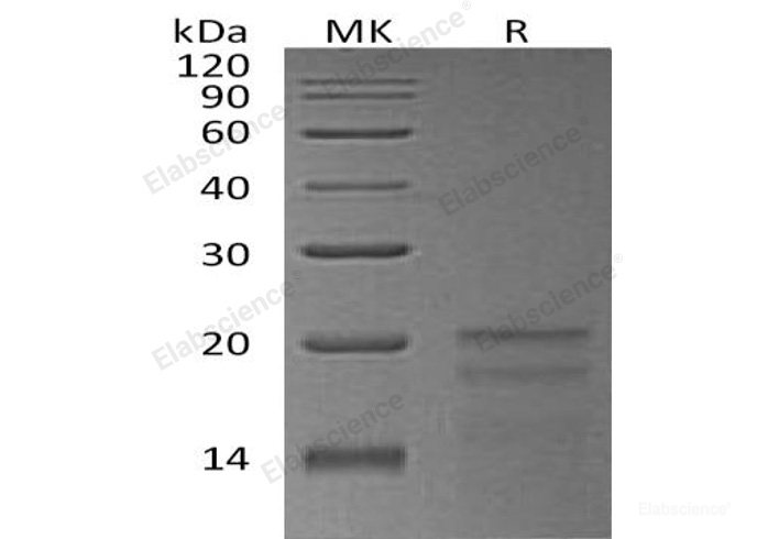 Recombinant Human Zinc Finger HIT Domain-Containing Protein 1/ZNHIT1/ZNFN4A1 Protein(N-6His)-Elabscience