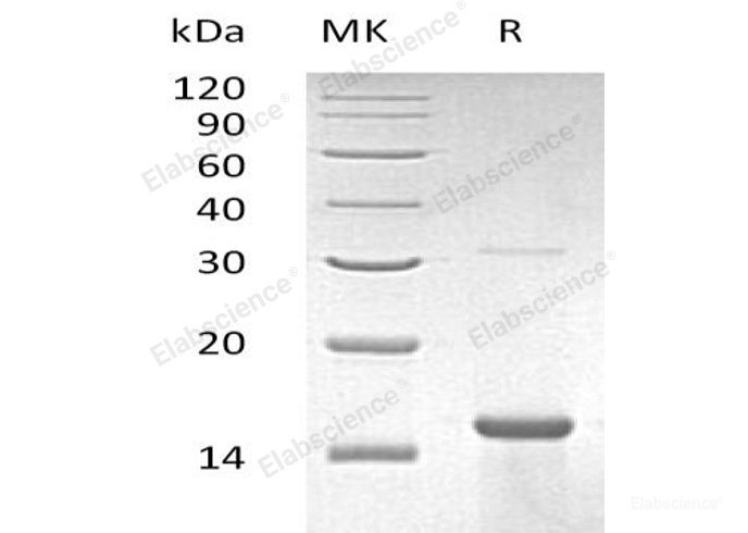 Recombinant Human Zinc Finger Protein 100/ZNF100 Protein(N-6His)-Elabscience