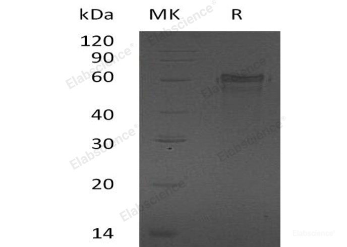 Recombinant Human Zinc Finger Protein 70/ZNF70 Protein(N-6His)-Elabscience
