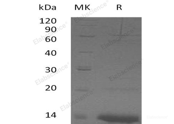 Recombinant Human Zinc Finger Protein 75A/ZNF75A Protein(N-6His)-Elabscience