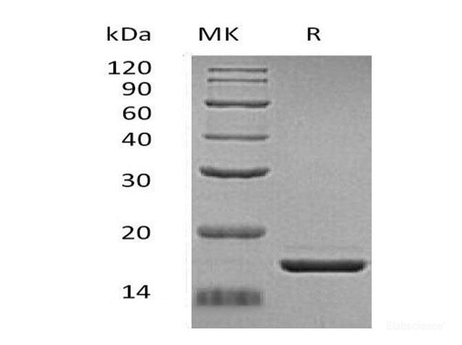 Recombinant Human Zymogen Granule Membrane Protein 16/ZG16 Protein(C-6His)-Elabscience
