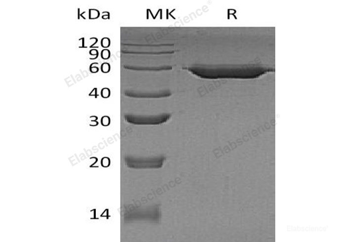 Recombinant Human α-Amylase 2B/AMY2B Protein(C-6His)-Elabscience